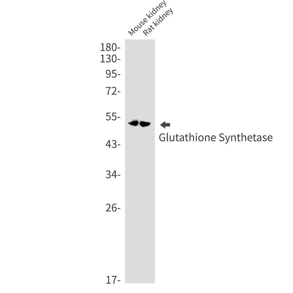 buy glutathione Metabolic acidosis in late pregnancy due to 5-oxoproline (pyroglutamic  acid)—A case report main image 1